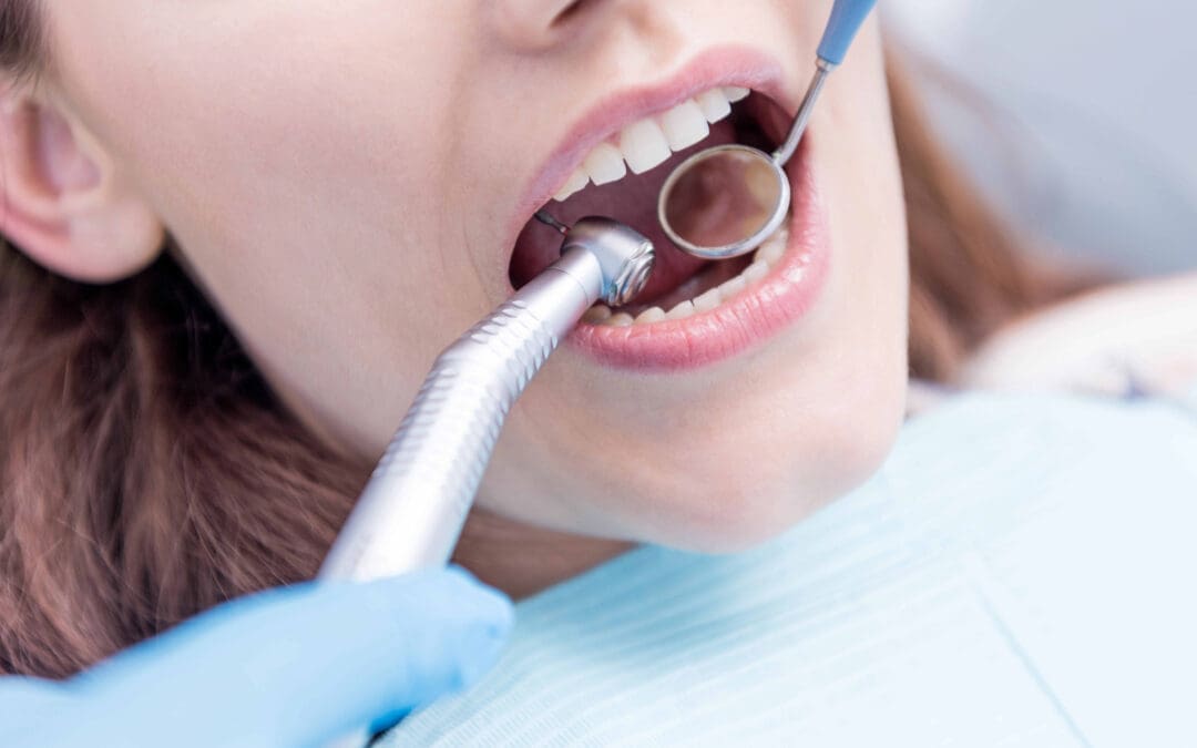 How Long Do Dental Fillings Last? Understanding Their Lifespan